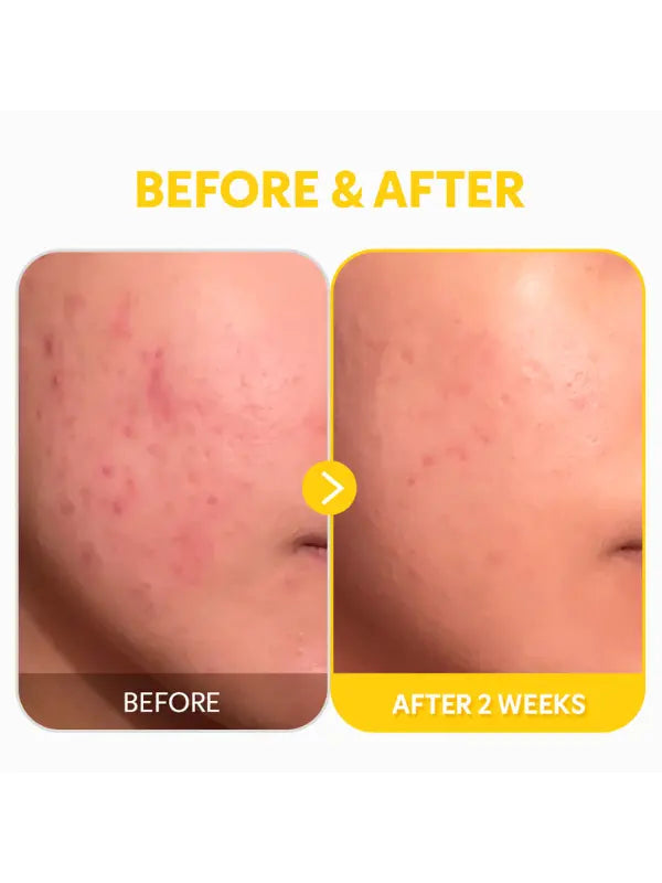 TIRTIR Pure Vitamin C 24 Serum 30ml-4